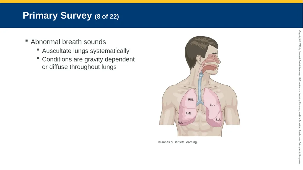Respiratory Emergencies CHAPTER 17 Introduction - slide 41 of 179