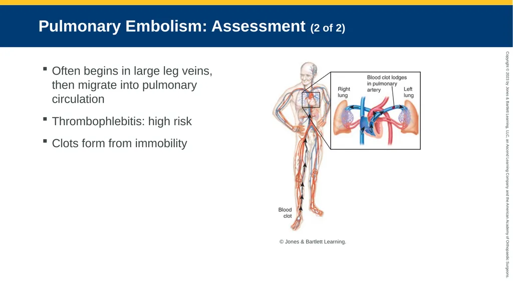 Respiratory Emergencies CHAPTER 17 Introduction - slide 176 of 179