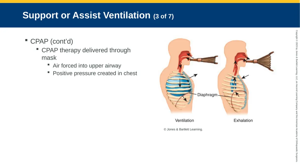 Respiratory Emergencies CHAPTER 17 Introduction - slide 96 of 179