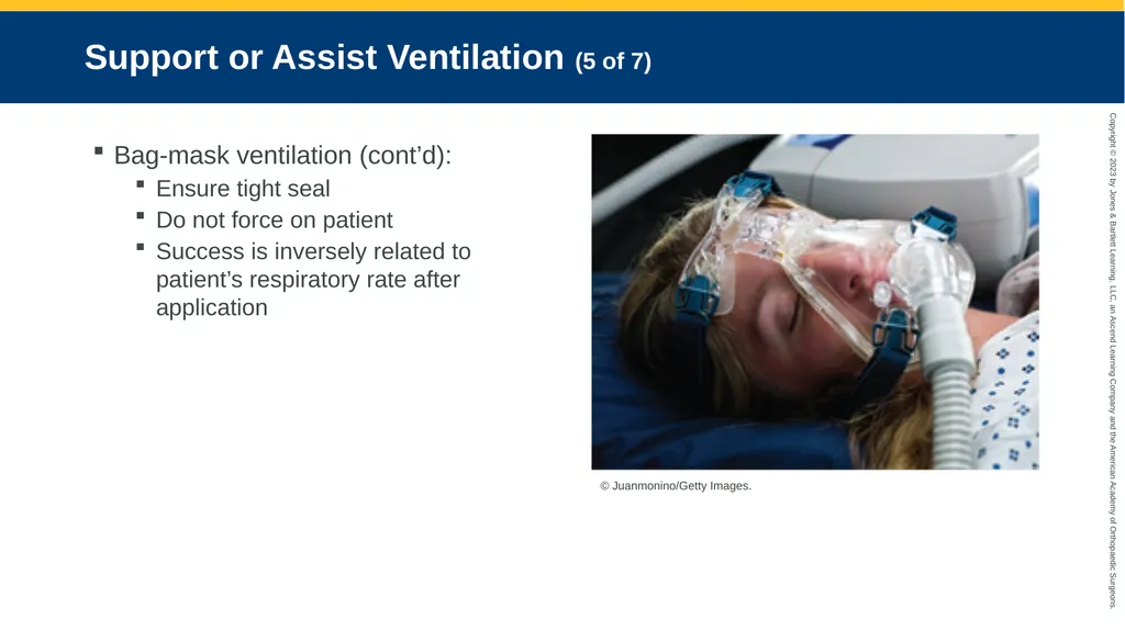 Respiratory Emergencies CHAPTER 17 Introduction - slide 98 of 179