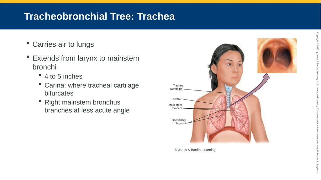 Respiratory Emergencies CHAPTER 17 Introduction - slide 6 of 179