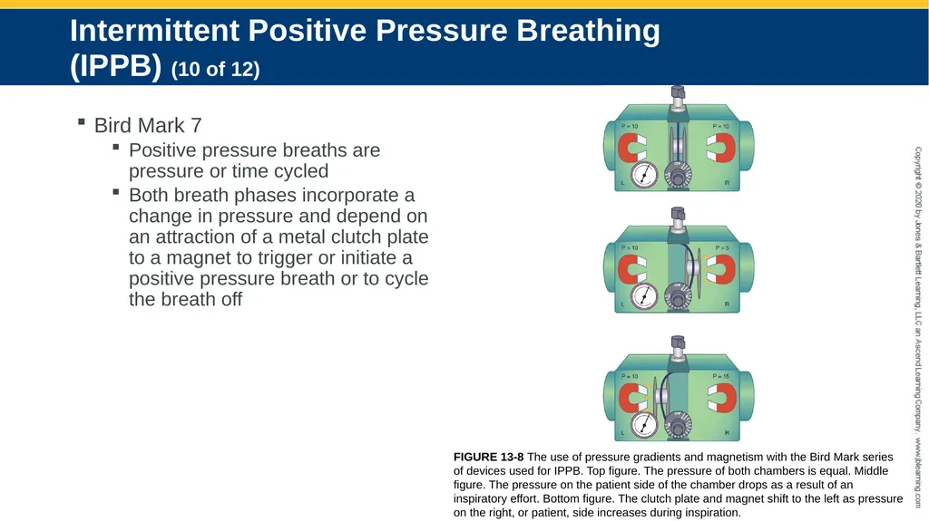 Hyperinflation Therapy CHAPTER 13 Objectives - slide 24 of 68