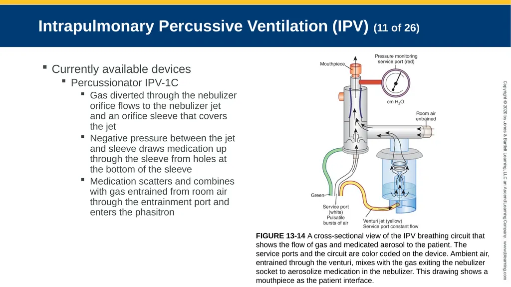 Hyperinflation Therapy CHAPTER 13 Objectives - slide 41 of 68