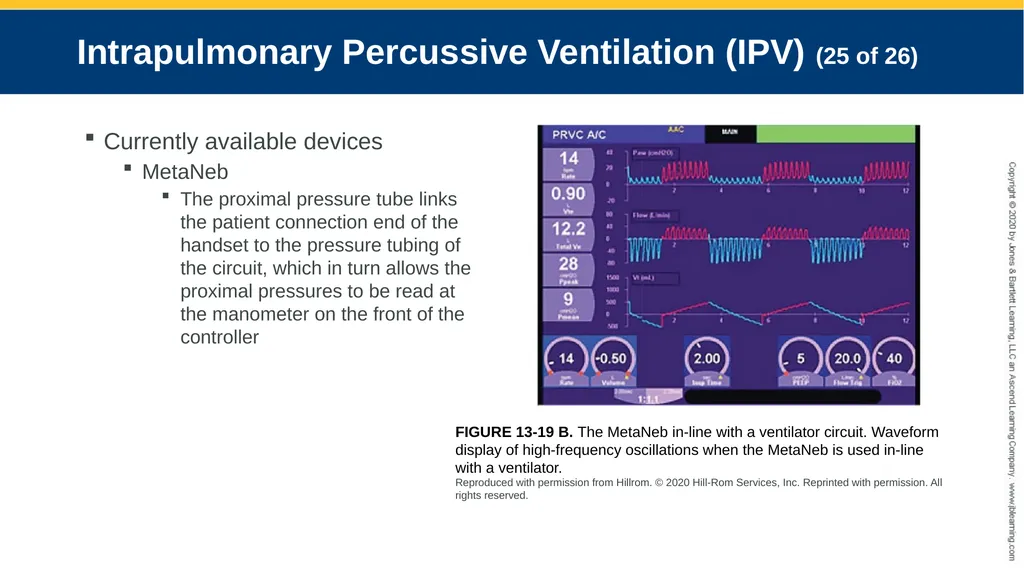 Hyperinflation Therapy CHAPTER 13 Objectives - slide 55 of 68