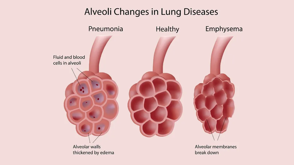 The lungs and breathing Learning objectives Define - slide 4 of 8