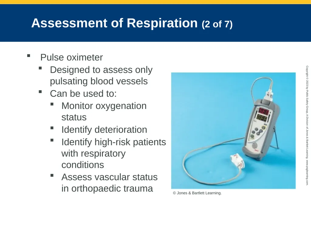 Airway Management CHAPTER 11: Focused Lecture - slide 55 of 139