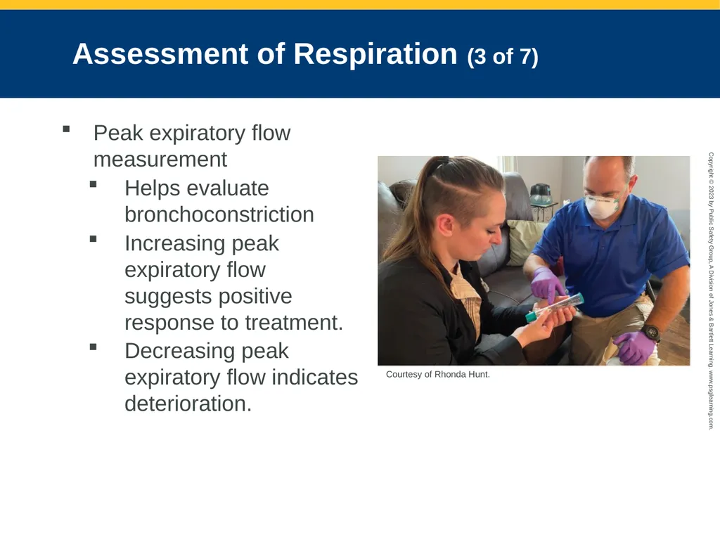 Airway Management CHAPTER 11: Focused Lecture - slide 56 of 139
