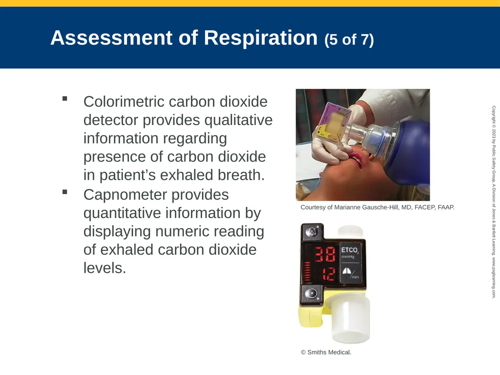 Airway Management CHAPTER 11: Focused Lecture - slide 58 of 139