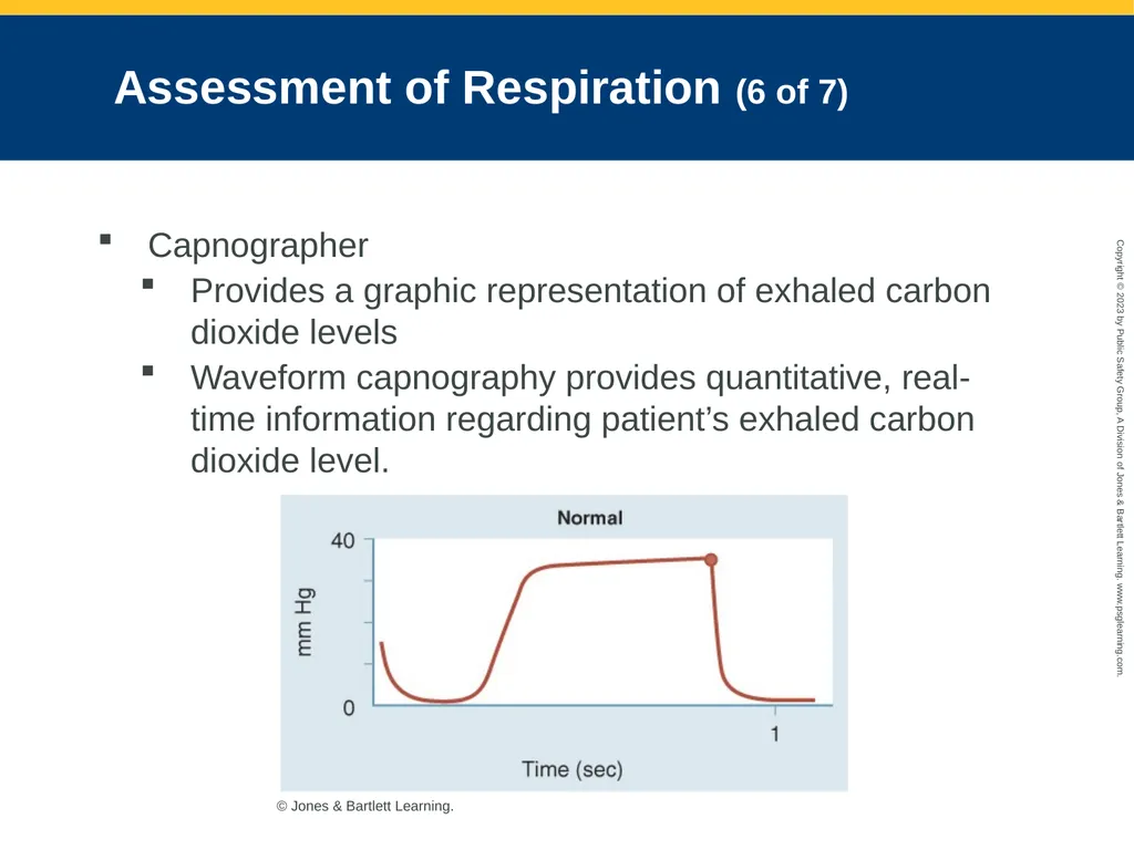 Airway Management CHAPTER 11: Focused Lecture - slide 59 of 139