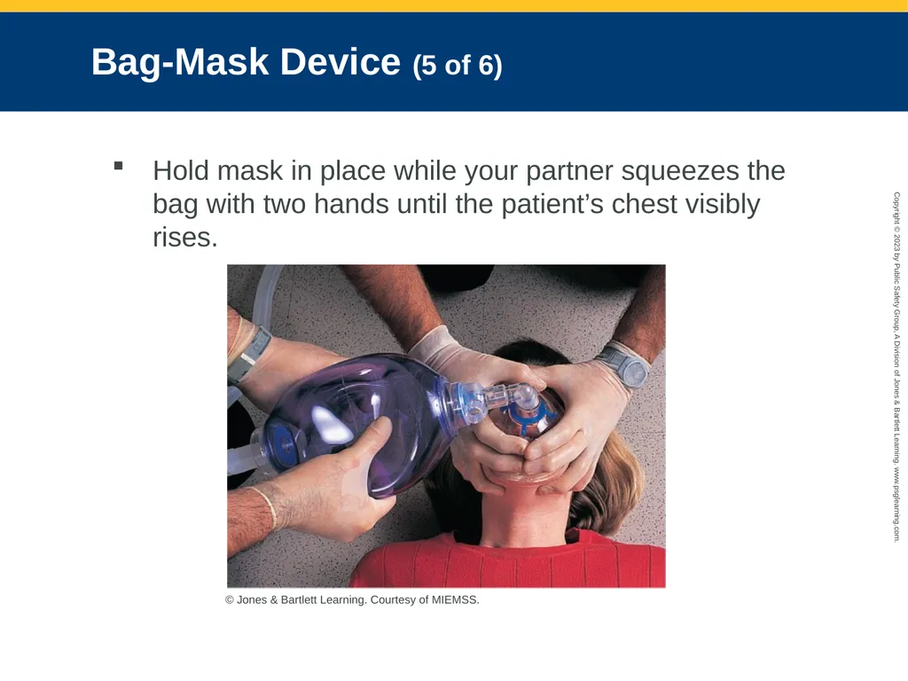 Airway Management CHAPTER 11: Focused Lecture - slide 96 of 139