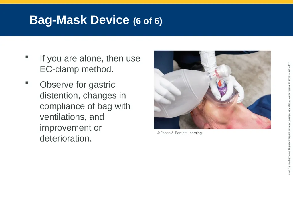 Airway Management CHAPTER 11: Focused Lecture - slide 97 of 139