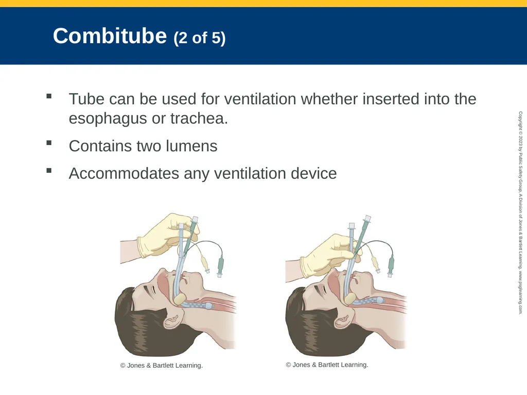 Airway Management CHAPTER 11: Focused Lecture - slide 130 of 139