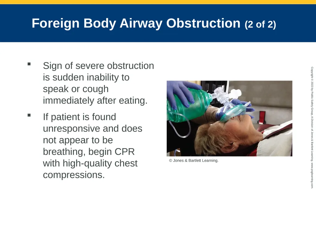 Airway Management CHAPTER 11: Focused Lecture - slide 116 of 139