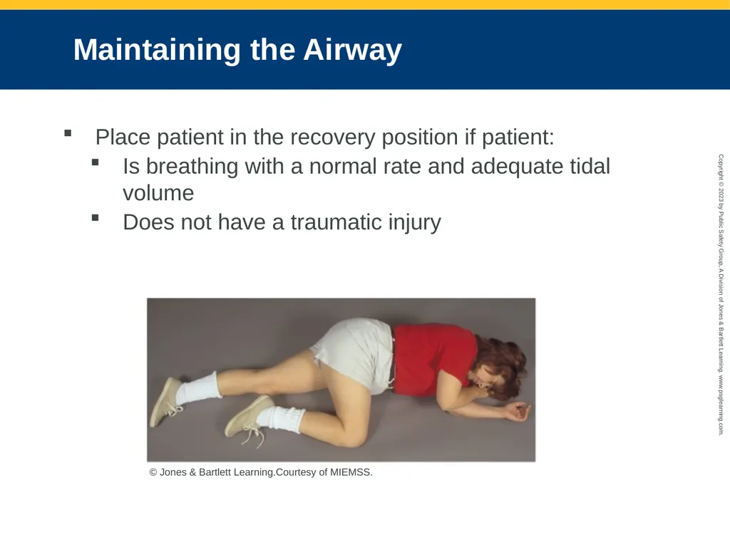 Airway Management CHAPTER 11: Focused Lecture - slide 65 of 139