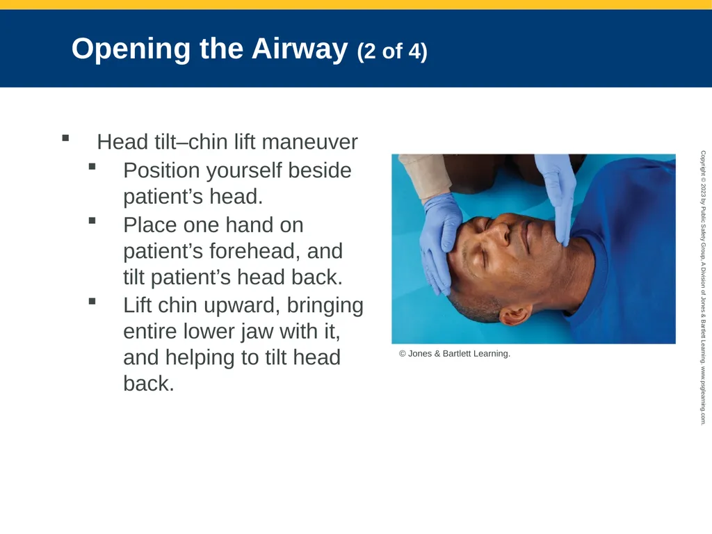 Airway Management CHAPTER 11: Focused Lecture - slide 62 of 139