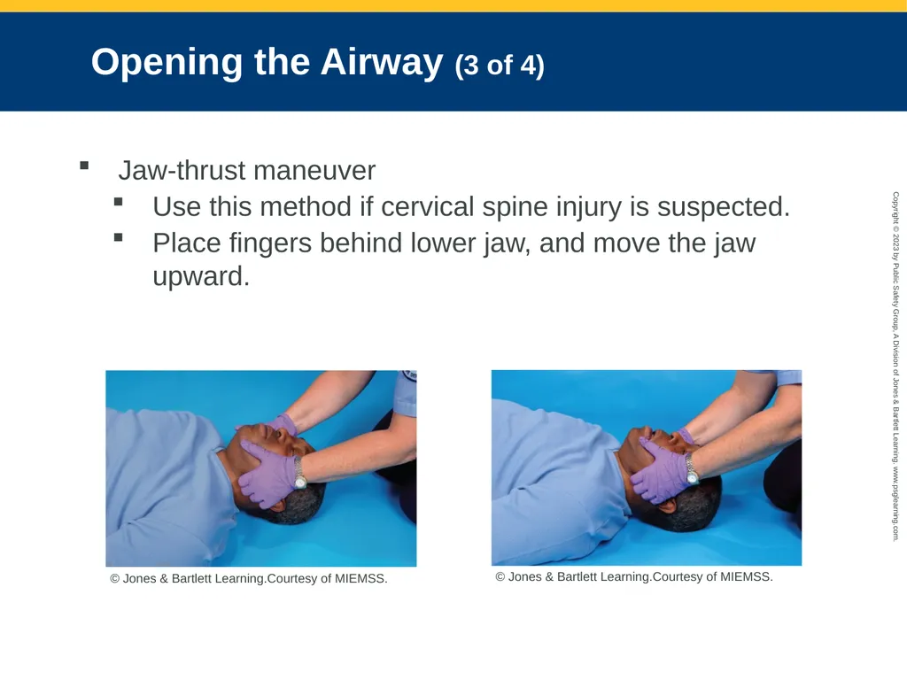 Airway Management CHAPTER 11: Focused Lecture - slide 63 of 139