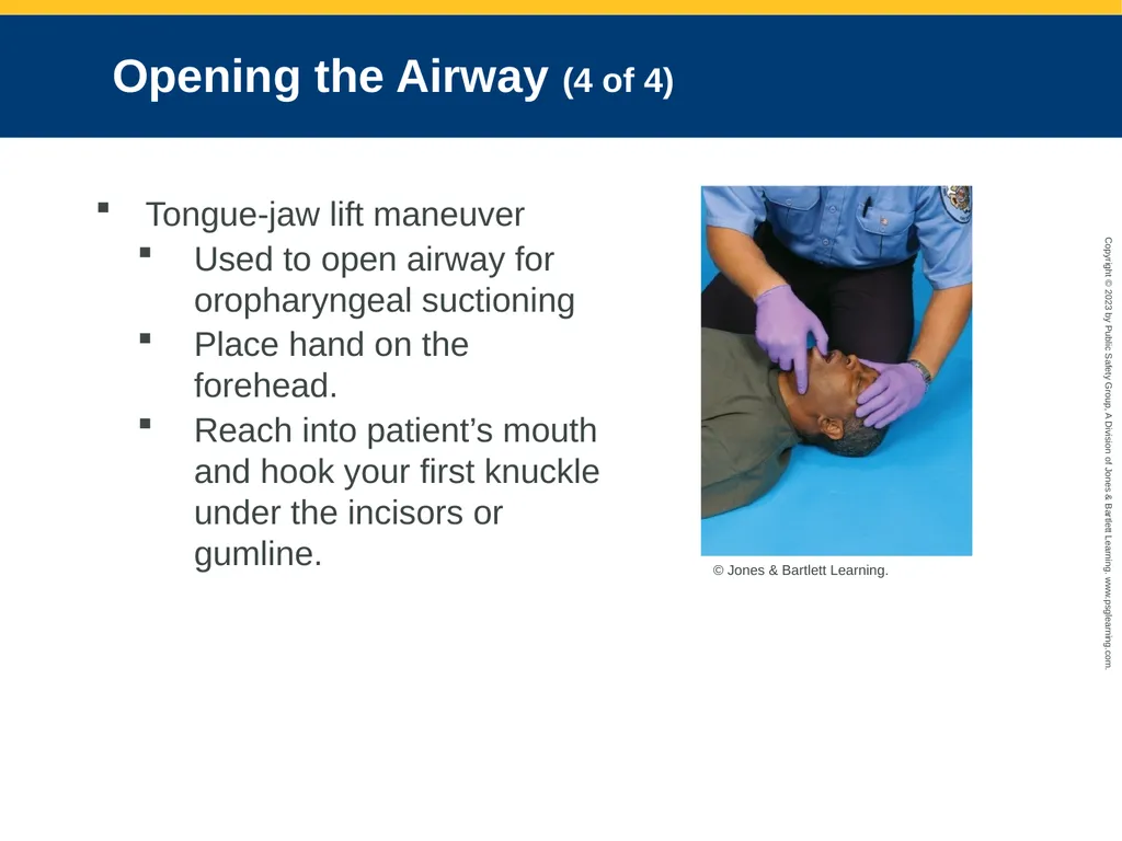 Airway Management CHAPTER 11: Focused Lecture - slide 64 of 139