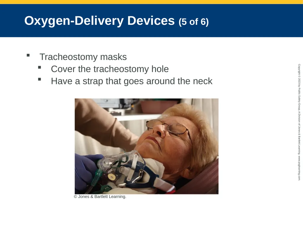 Airway Management CHAPTER 11: Focused Lecture - slide 85 of 139