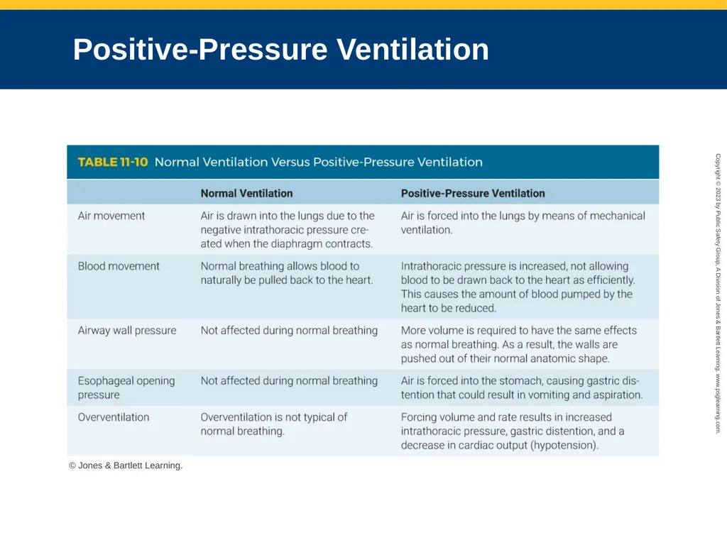 Airway Management CHAPTER 11: Focused Lecture - slide 89 of 139
