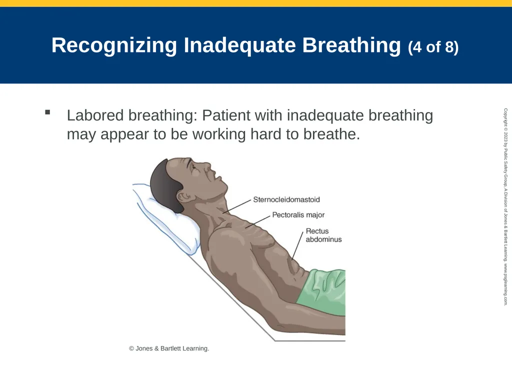 Airway Management CHAPTER 11: Focused Lecture - slide 49 of 139