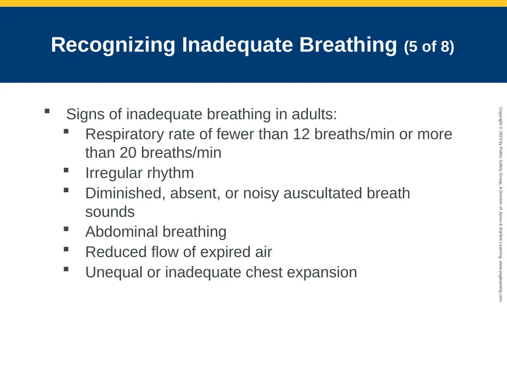 Airway Management CHAPTER 11: Focused Lecture - slide 50 of 139