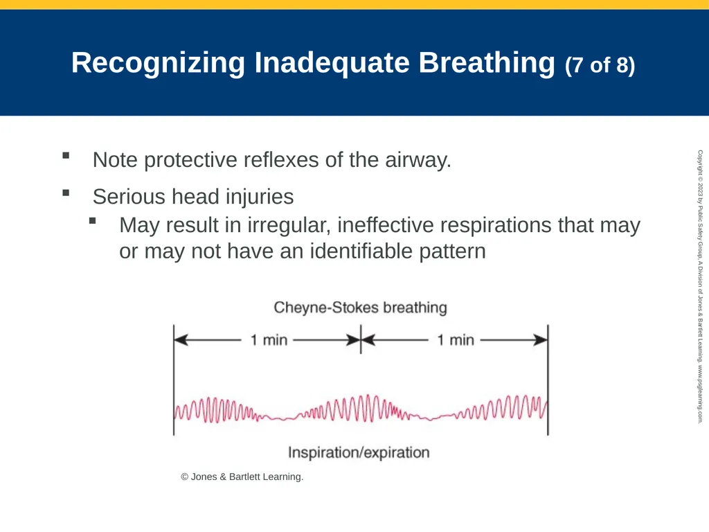 Airway Management CHAPTER 11: Focused Lecture - slide 52 of 139