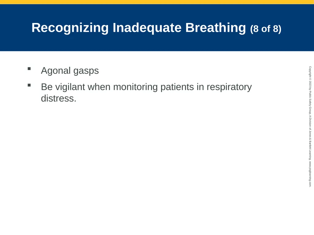 Airway Management CHAPTER 11: Focused Lecture - slide 53 of 139