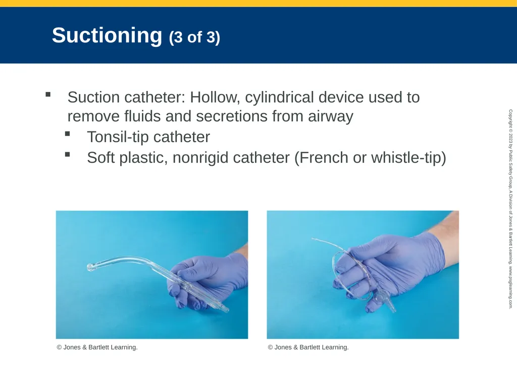 Airway Management CHAPTER 11: Focused Lecture - slide 68 of 139