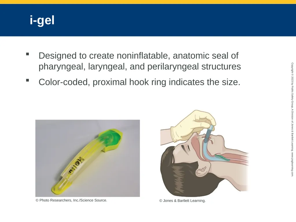 Airway Management CHAPTER 11: Focused Lecture - slide 125 of 139