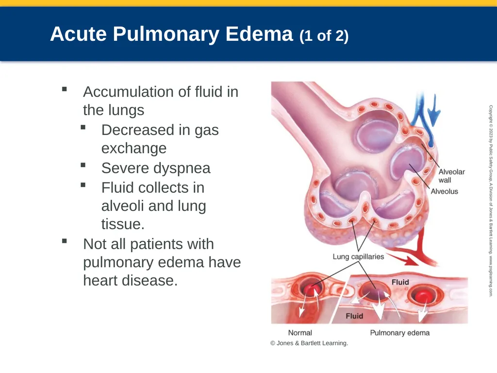 Respiratory Emergencies CHAPTER 17: Focused - slide 24 of 106