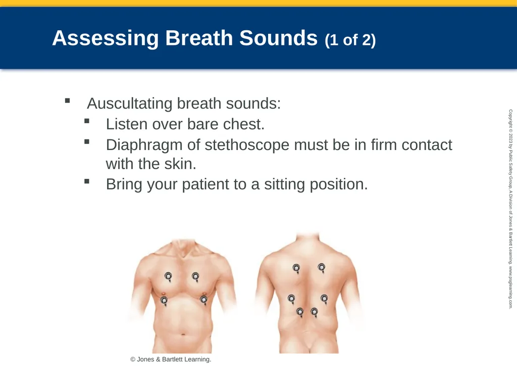 Respiratory Emergencies CHAPTER 17: Focused - slide 57 of 106