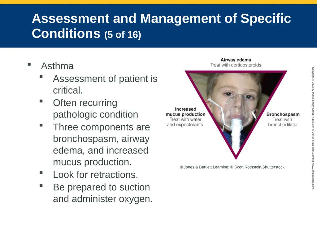 Respiratory Emergencies CHAPTER 17: Focused - slide 84 of 106