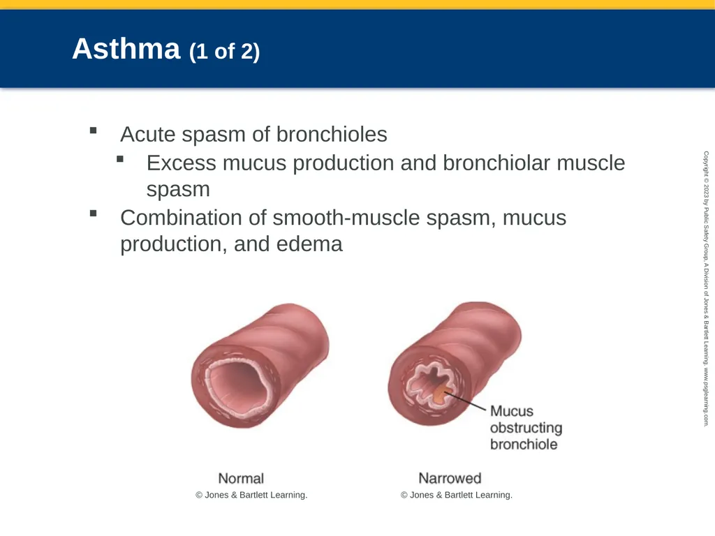 Respiratory Emergencies CHAPTER 17: Focused - slide 30 of 106