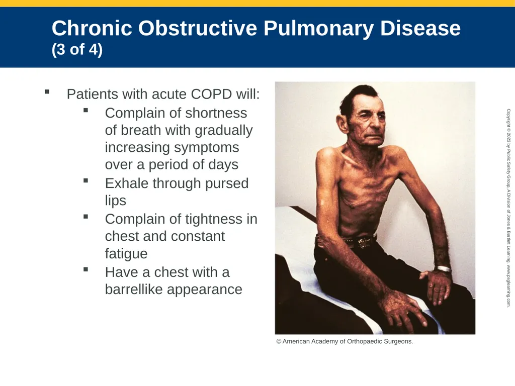 Respiratory Emergencies CHAPTER 17: Focused - slide 28 of 106