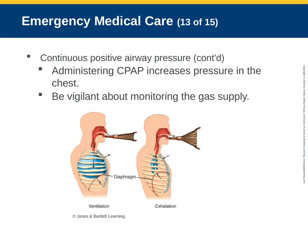 Respiratory Emergencies CHAPTER 17: Focused - slide 77 of 106