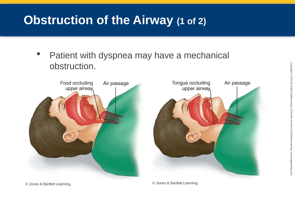 Respiratory Emergencies CHAPTER 17: Focused - slide 40 of 106