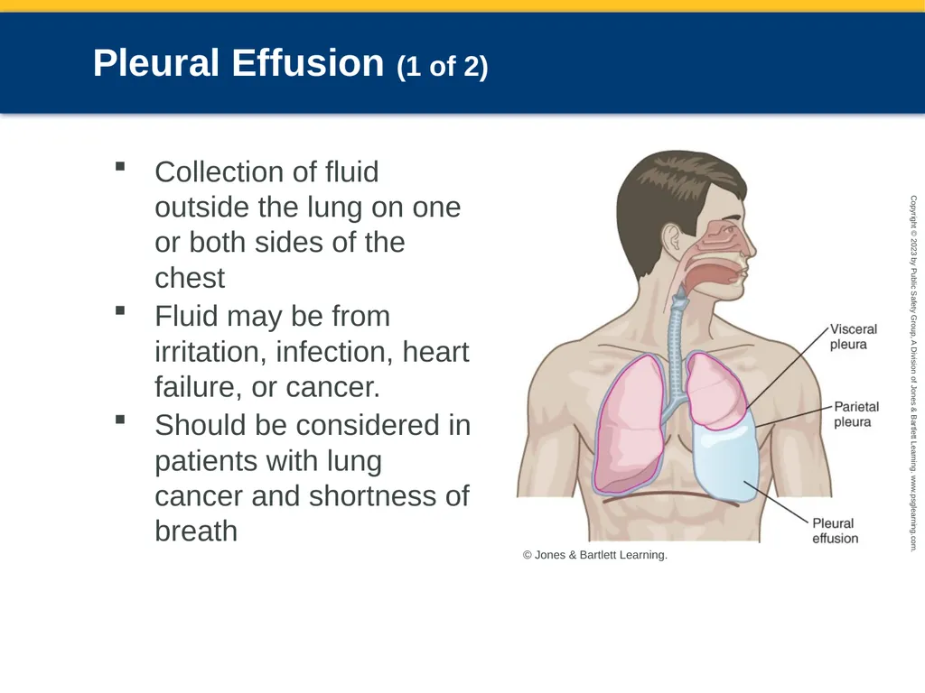 Respiratory Emergencies CHAPTER 17: Focused - slide 35 of 106