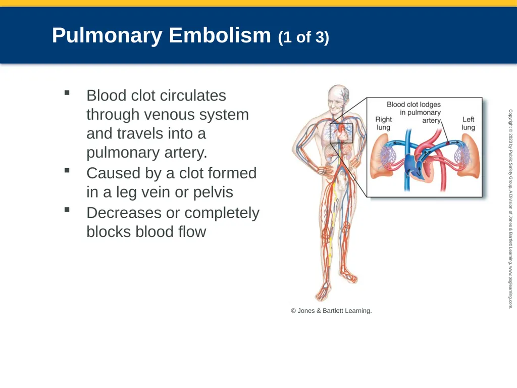 Respiratory Emergencies CHAPTER 17: Focused - slide 37 of 106