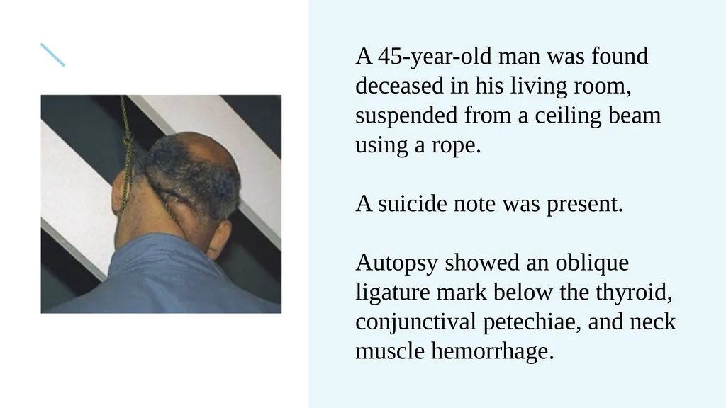 The Forensics of Violent Asphyxia Make sure to - slide 3 of 17