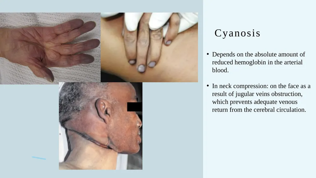 The Forensics of Violent Asphyxia Make sure to - slide 13 of 17