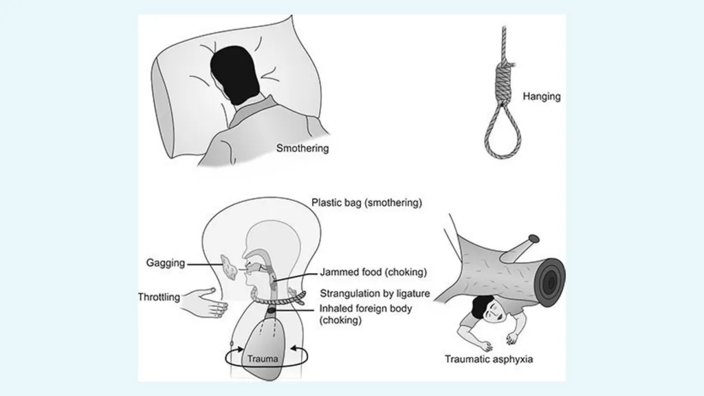 The Forensics of Violent Asphyxia Make sure to - slide 4 of 17