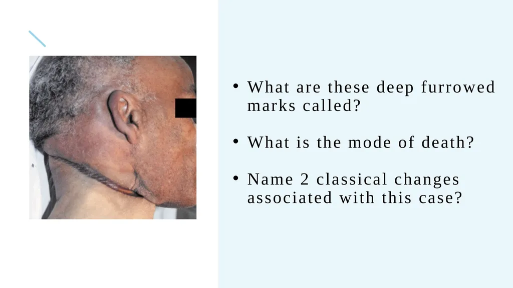 The Forensics of Violent Asphyxia Make sure to - slide 17 of 17