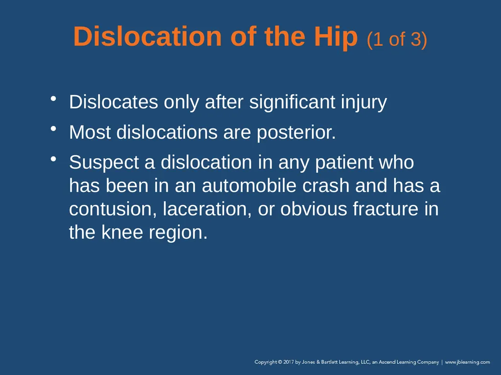 Chapter 31 Orthopaedic Injuries National EMS - slide 88 of 152