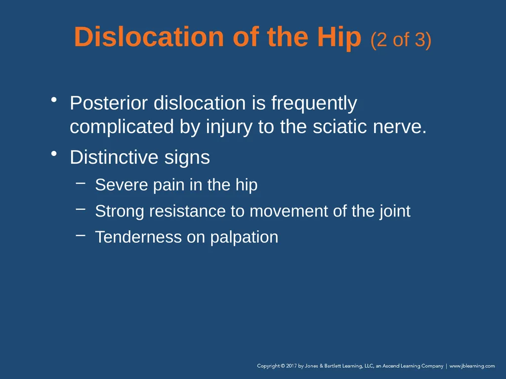 Chapter 31 Orthopaedic Injuries National EMS - slide 89 of 152