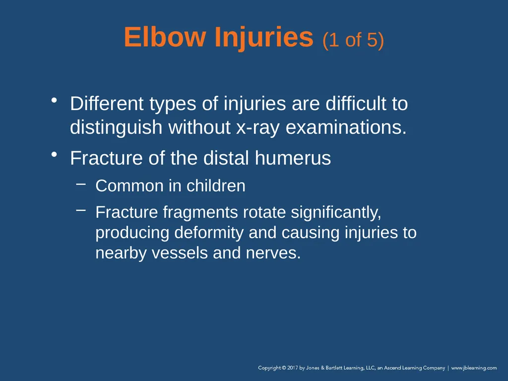 Chapter 31 Orthopaedic Injuries National EMS - slide 78 of 152