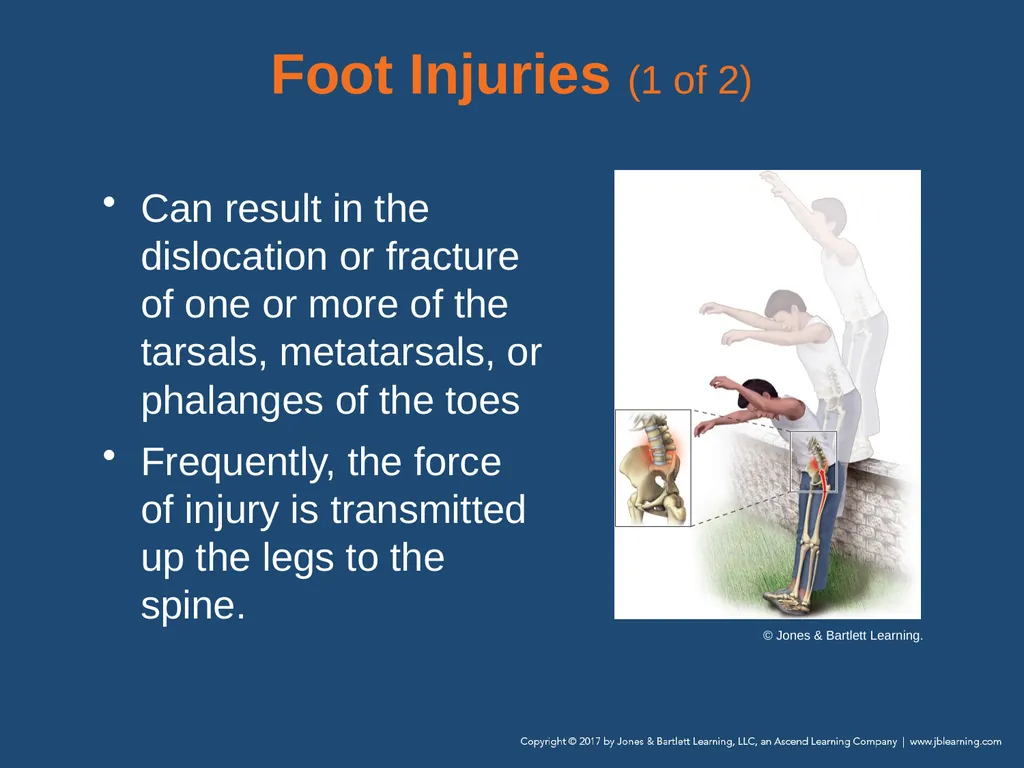 Chapter 31 Orthopaedic Injuries National EMS - slide 105 of 152