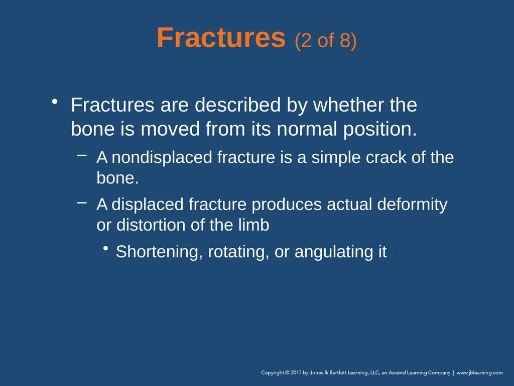 Chapter 31 Orthopaedic Injuries National EMS - slide 26 of 152