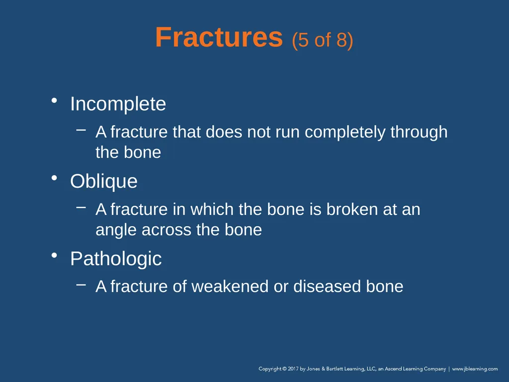 Chapter 31 Orthopaedic Injuries National EMS - slide 29 of 152