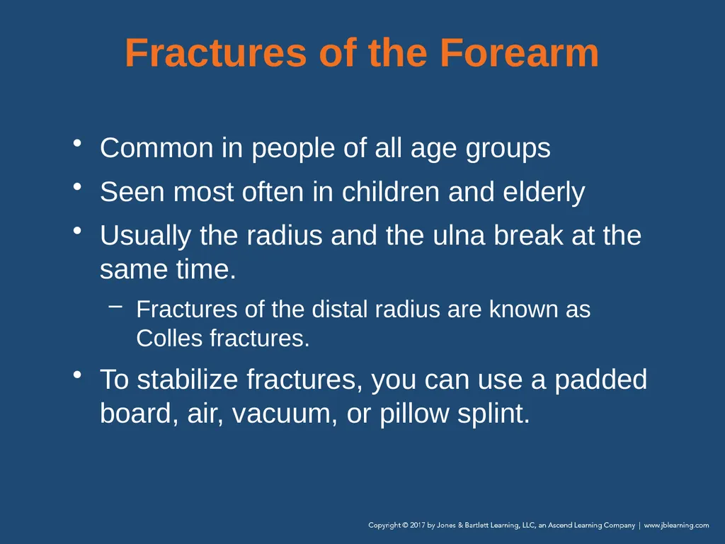Chapter 31 Orthopaedic Injuries National EMS - slide 83 of 152