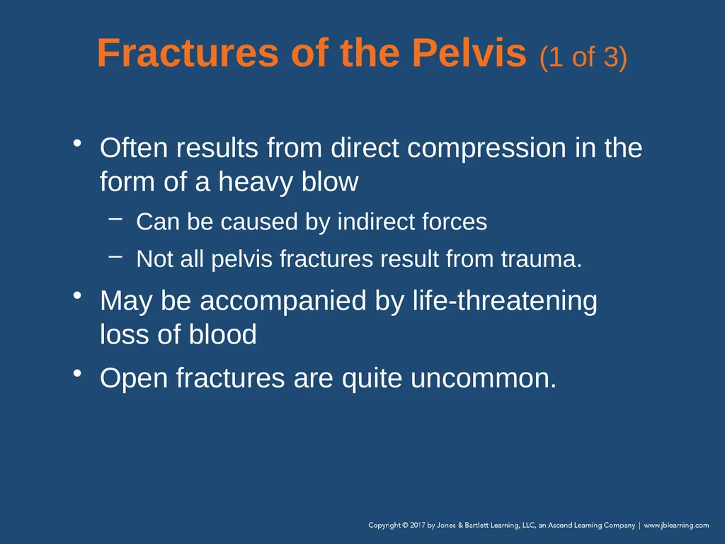 Chapter 31 Orthopaedic Injuries National EMS - slide 85 of 152